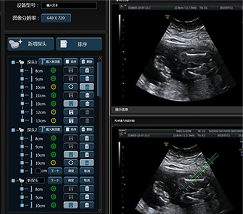 武漢睿影醫療科技超聲系統軟件界面設計